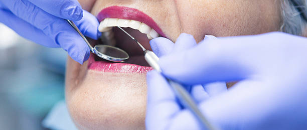 Best Emergency Dental Care for Broken or Chipped Teeth in Leesburg, FL